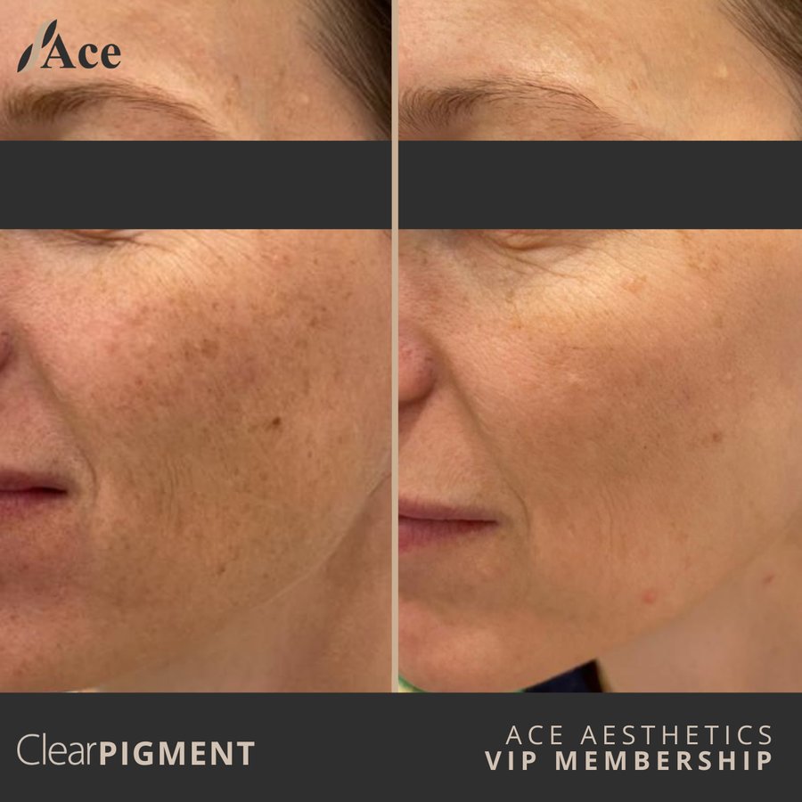 Ace Aesthetics - Ace Aesthetics